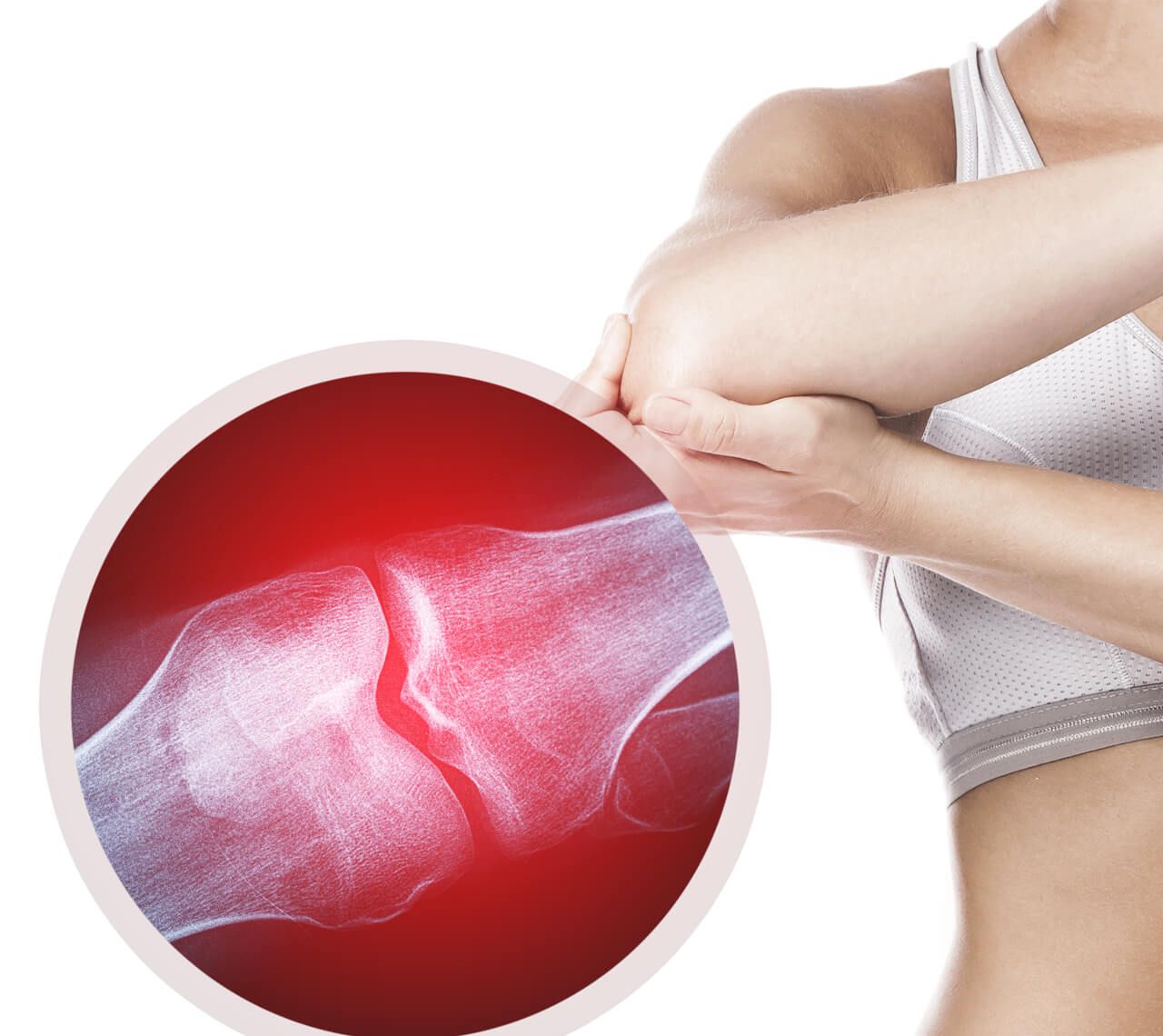sports related injuries