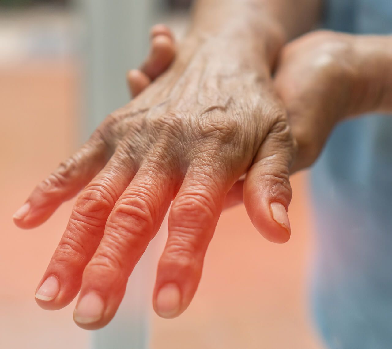 arthritis 